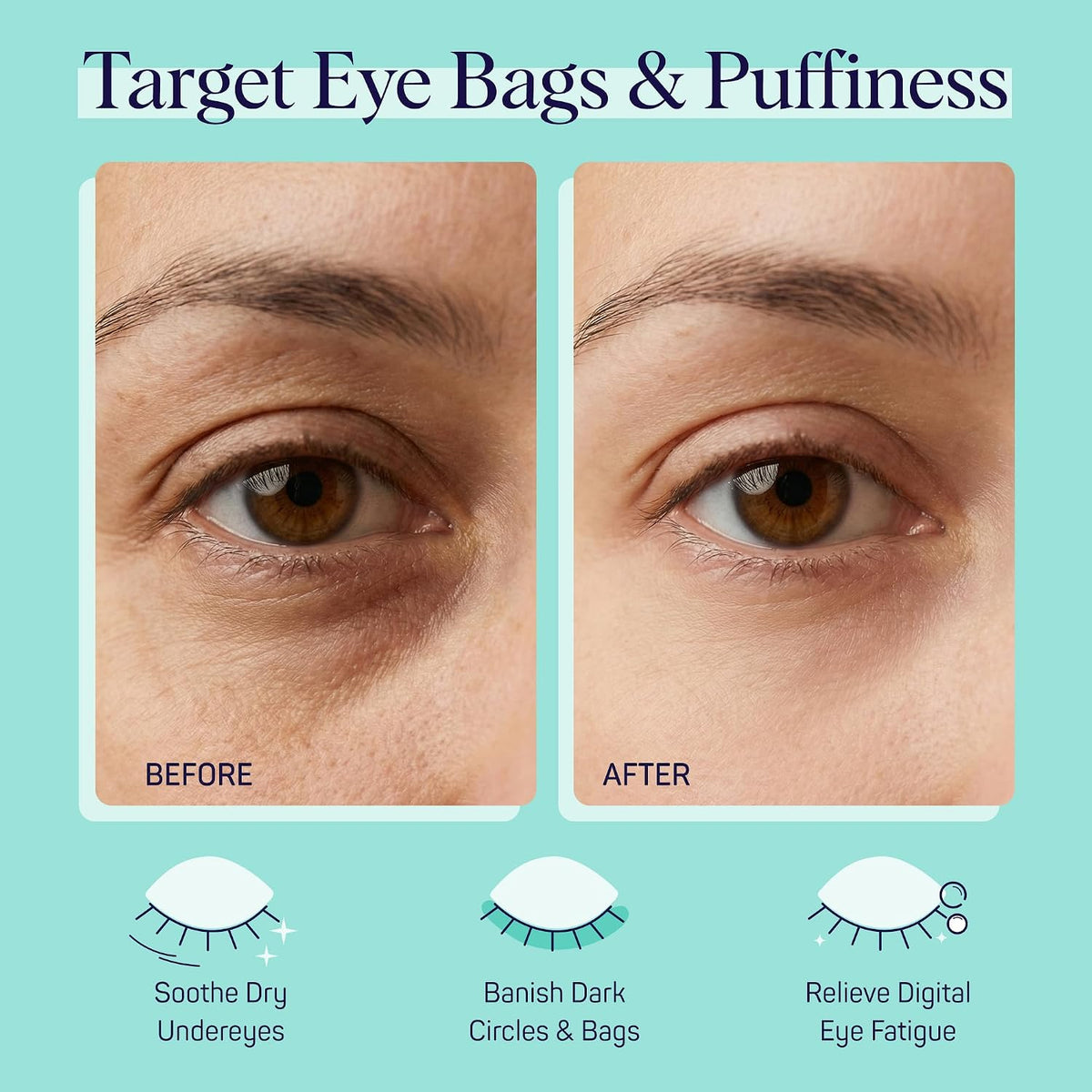 48 individual pre-soaked cucumber eye patches per set covering 24 complete treatments