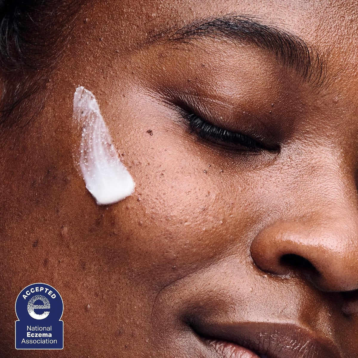 AESTURA ATOBARRIER365 Cream – Fragrance-Free Barrier Cream for Post-Microneedling Recovery