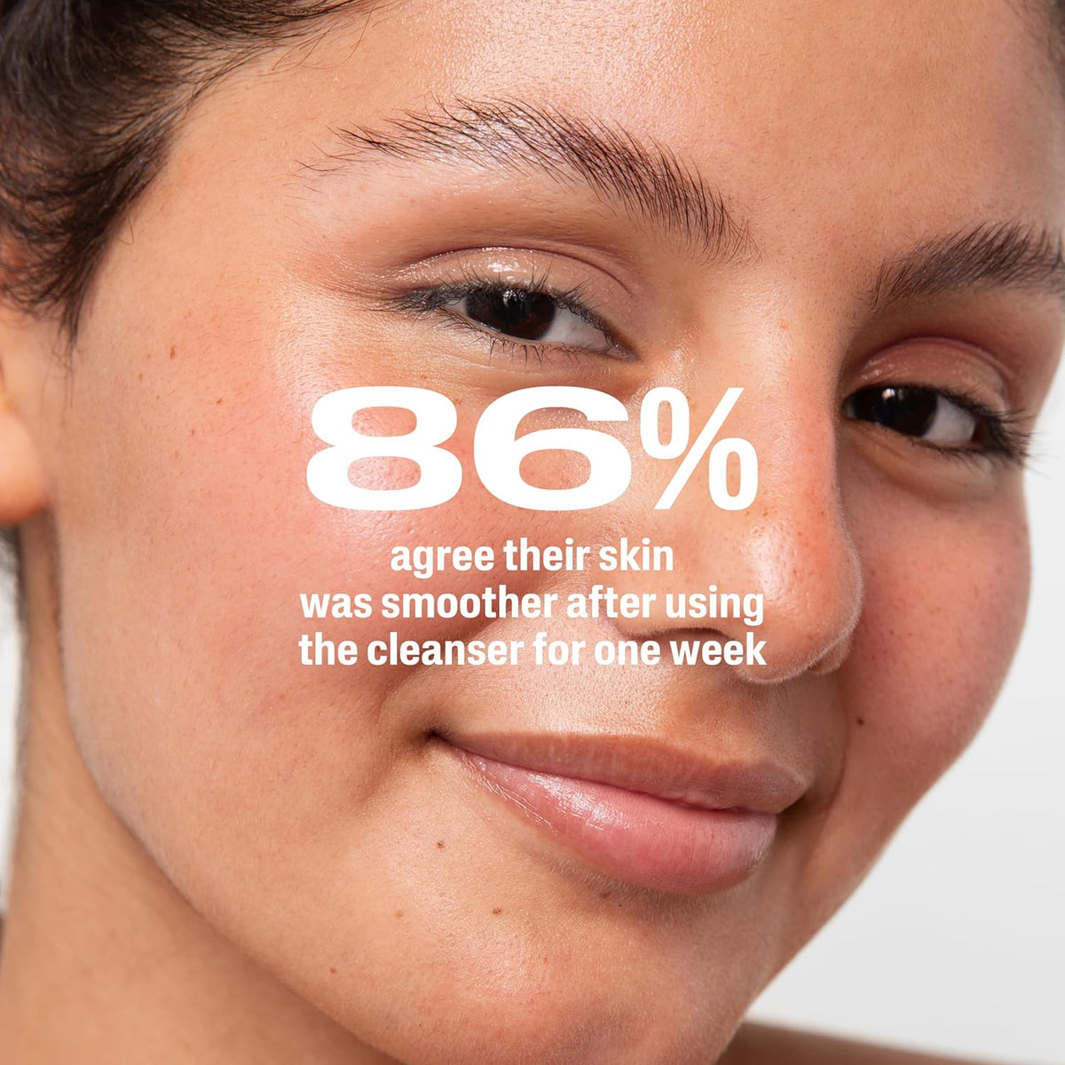 Cetaphil Gentle Clear 2.6% Benzoyl Peroxide Wash – Gentle Acne Care for Teenagers and Young Adults