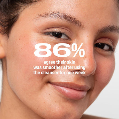 Cetaphil Gentle Clear 2.6% Benzoyl Peroxide Wash – Gentle Acne Care for Teenagers and Young Adults