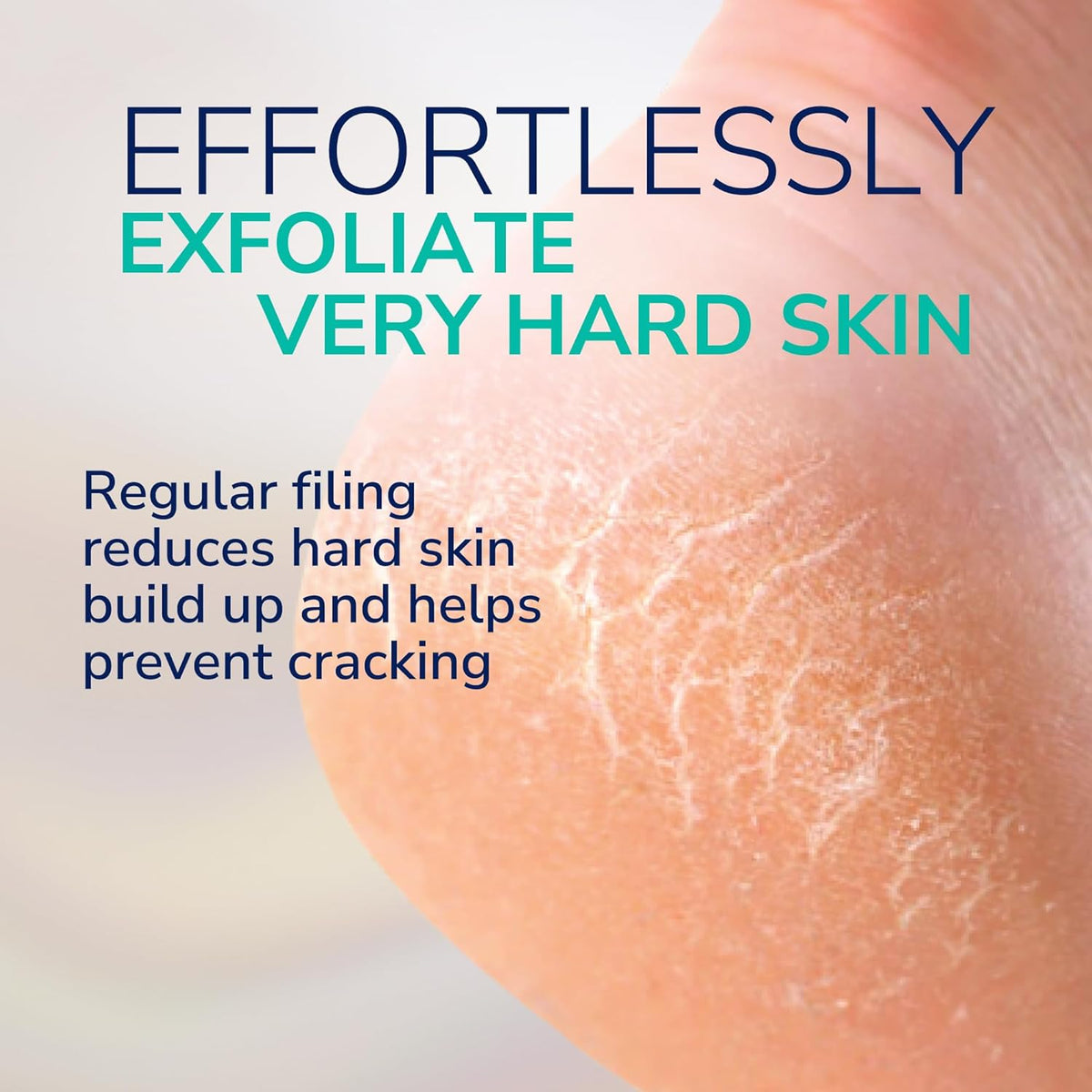 Dr. Scholl's Callus Remover for Feet – Easy Last-Minute Gift for Partner, Travel-Friendly Foot Care Gift