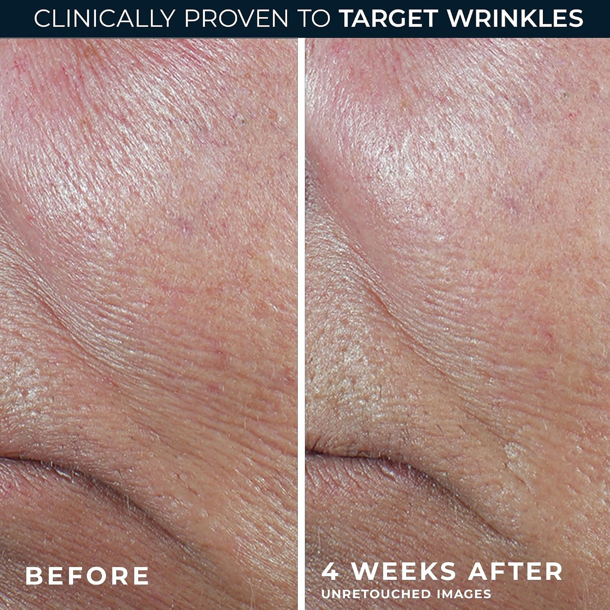dermatologist-tested, hypoallergenic, fragrance-free, paraben-free, non-comedogenic formulation