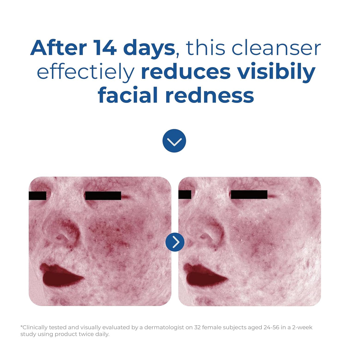 EltaMD Barrier-Strengthening Facial Cleanser – Wind-Down Evening Routine for Reactive Skin
