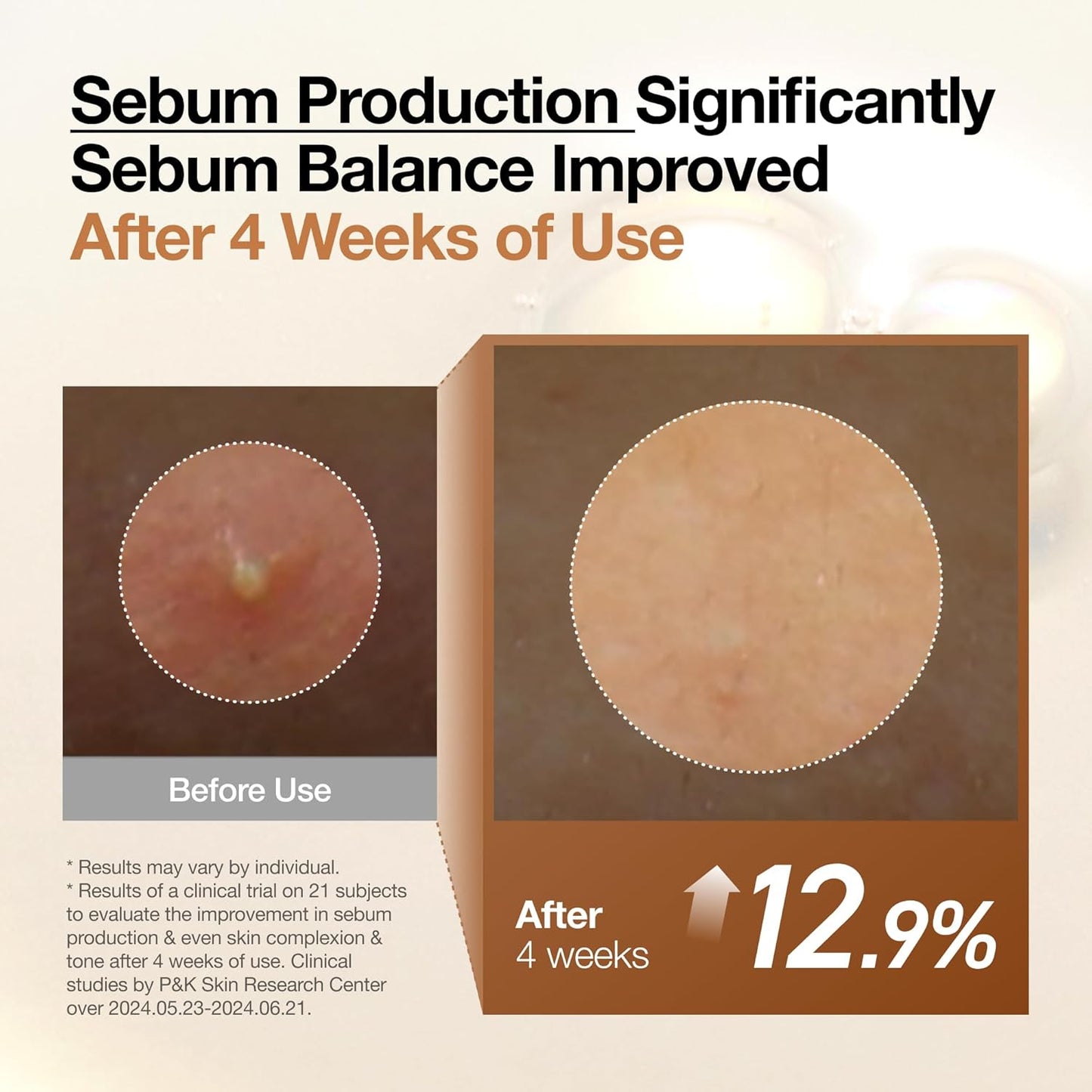 fragrance-free, non-comedogenic, and suitable for all skin types including sensitive and oily