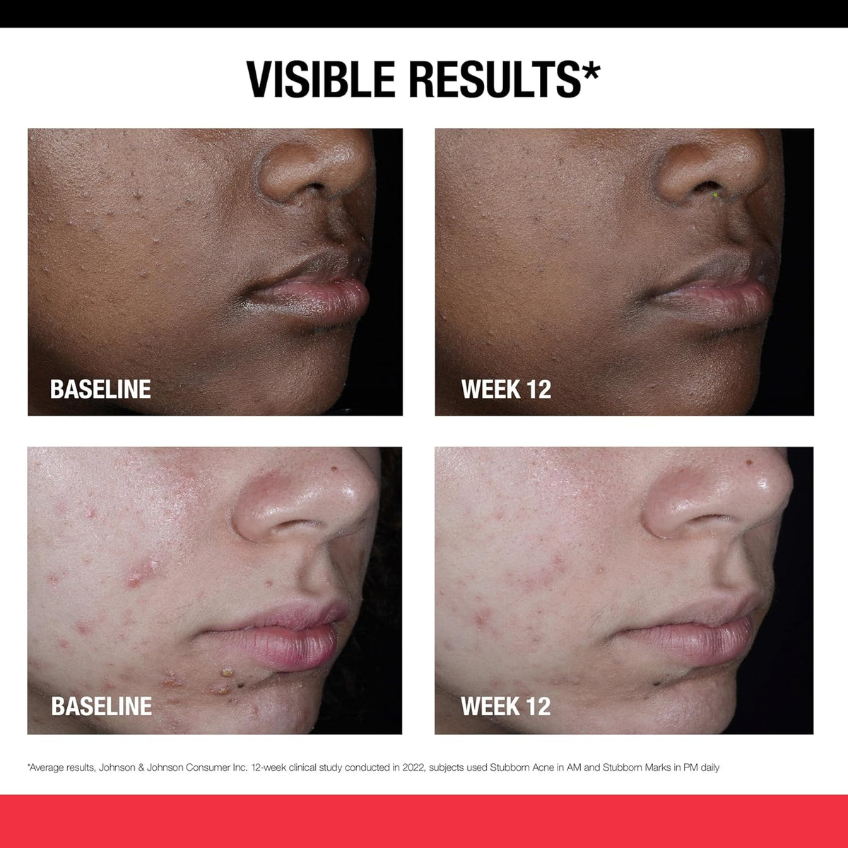 non-comedogenic and oil-free base