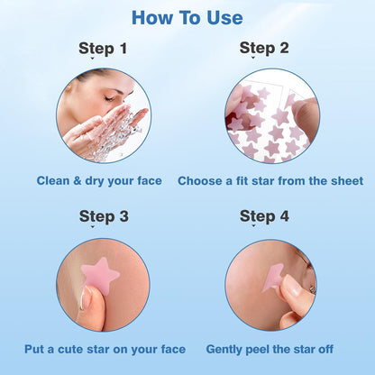 QUSTERE Star Pimple Stickers – Secure Adhesion That Won't Peel or Shift Overnight, Dermatologist-Tested 200 Count
