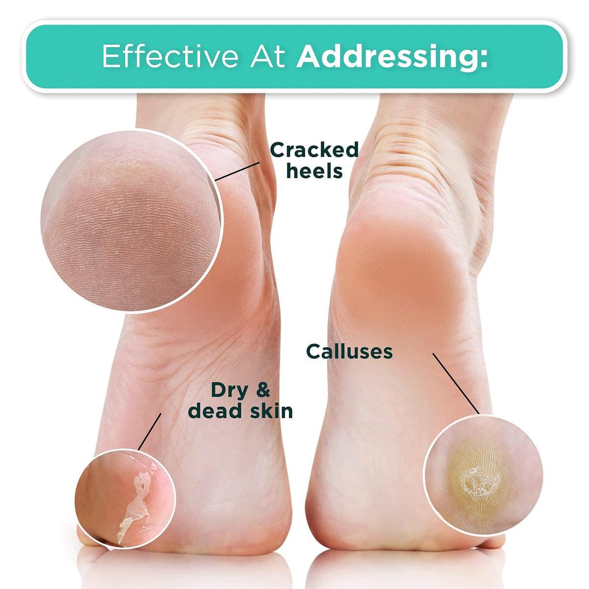 DERMORA Foot Peel Mask – Wind-Down Spa Treatment, Baby Soft Feet Pedicure Alternative