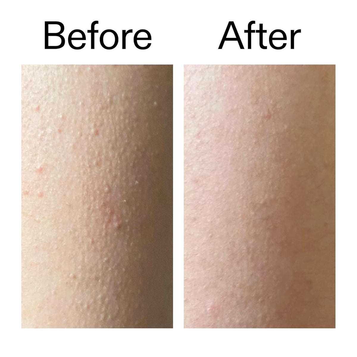 The INKEY List Glycolic Acid Stick – Fast, Distraction-Free Exfoliation for Multitasking Professionals